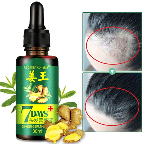 Hair Essential Oil Hair Care Oil Hairdressing Hair Repair Mask Ginger King 7 Days Essential Oil Dry and Damaged Hair Nutrition