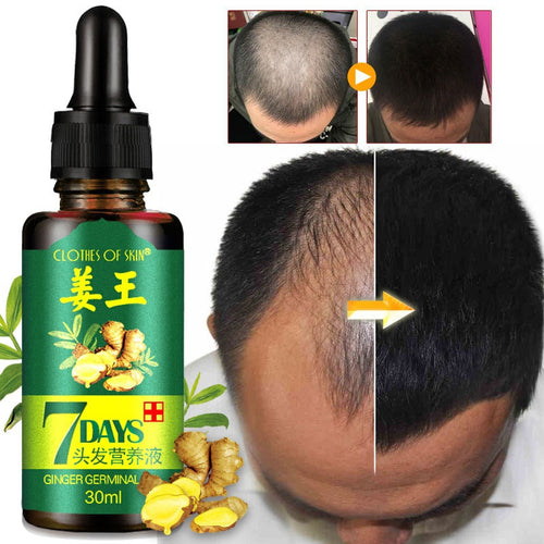 1Pc 7 Days Hair Ginger Germinal Serum Essence Oil 30ML Natural Hair Loss Treatement Effective Fast Growth Hair Care TSLM2