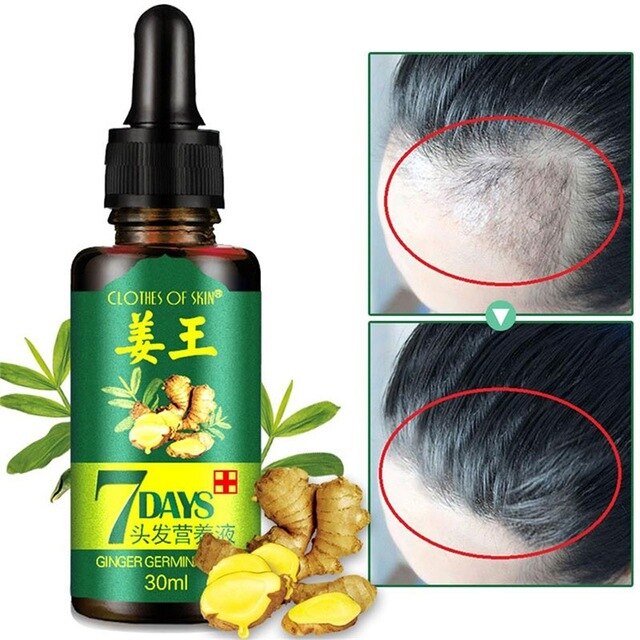 1Pc 7 Days Hair Ginger Germinal Serum Essence Oil 30ML Natural Hair Loss Treatement Effective Fast Growth Hair Care TSLM2