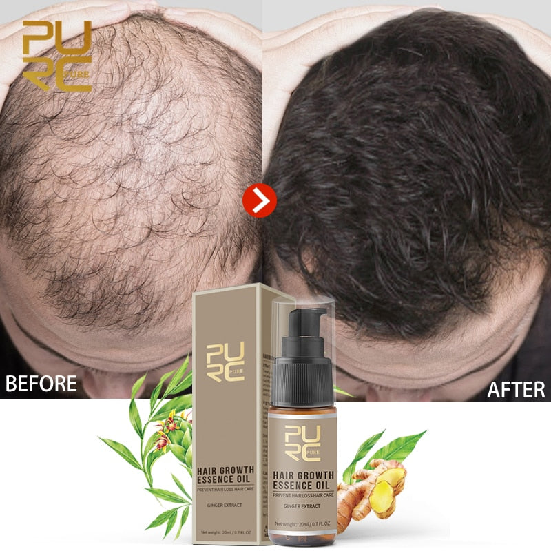 PURC Hot sale Fast Hair Growth Essence Oil Hair Loss Treatment Help for hair Growth Hair Care 20ml